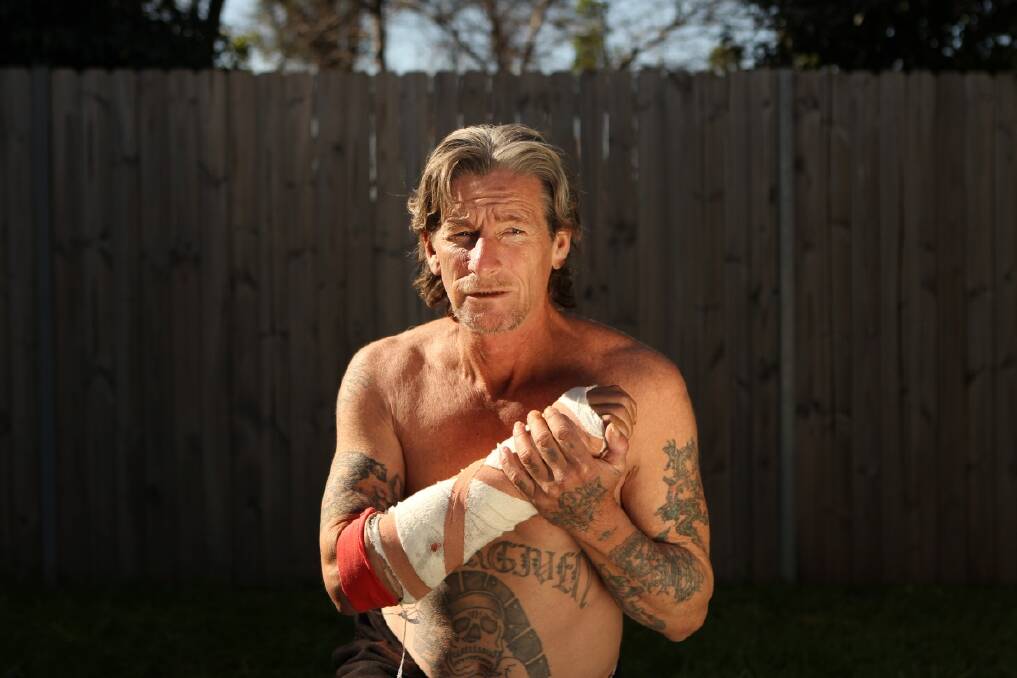 Portrait of Robbie Nelson who was attacked recently by three American pit bulls while exercising in the park near his home in Western Sydney. Photo: Jacky Ghossein 